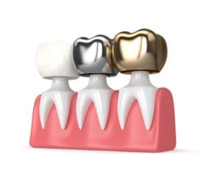 Dental Crowns Melrose MA