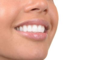 teeth whitening Melrose MA