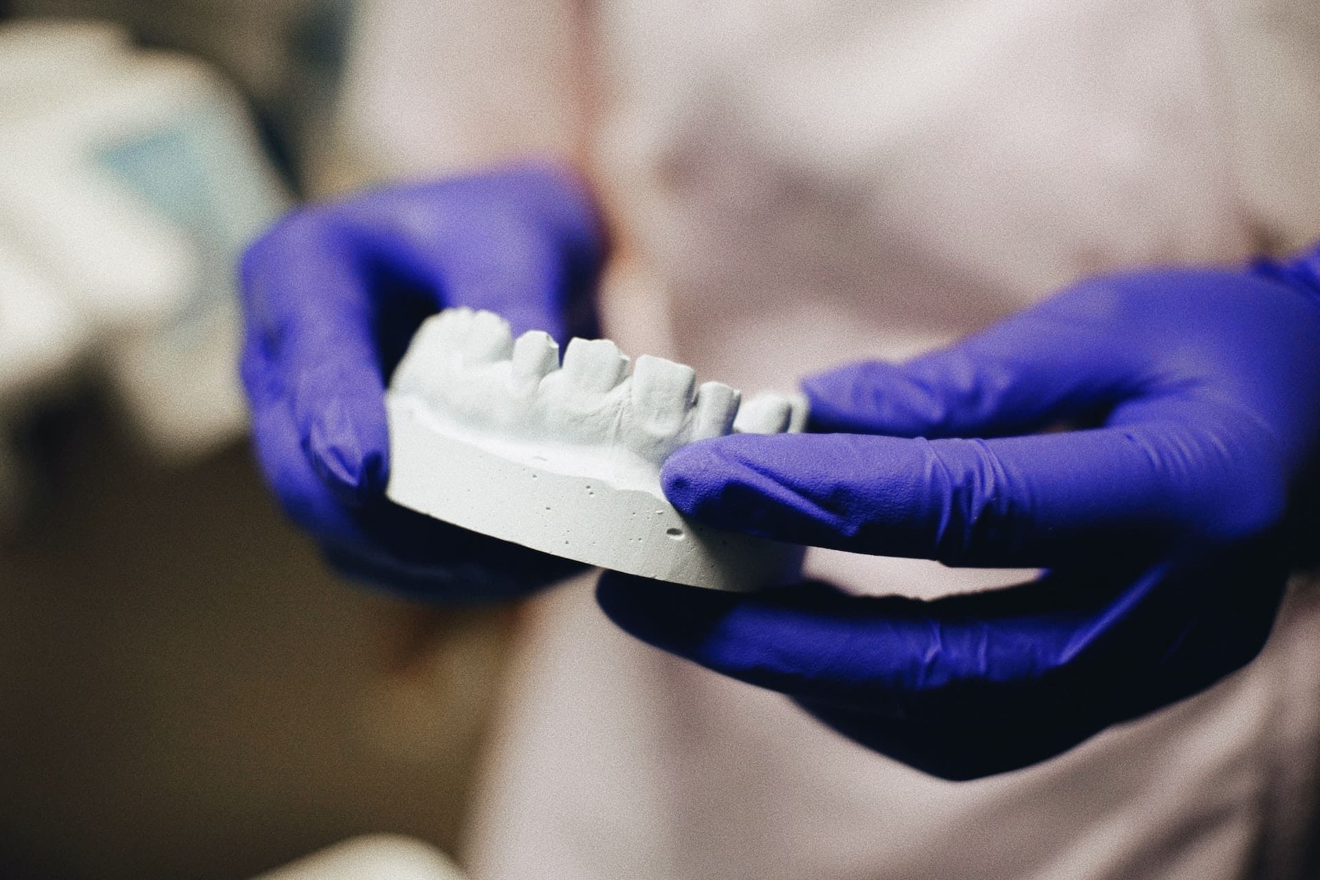 Dental professional holding a model of the lower arch of teeth