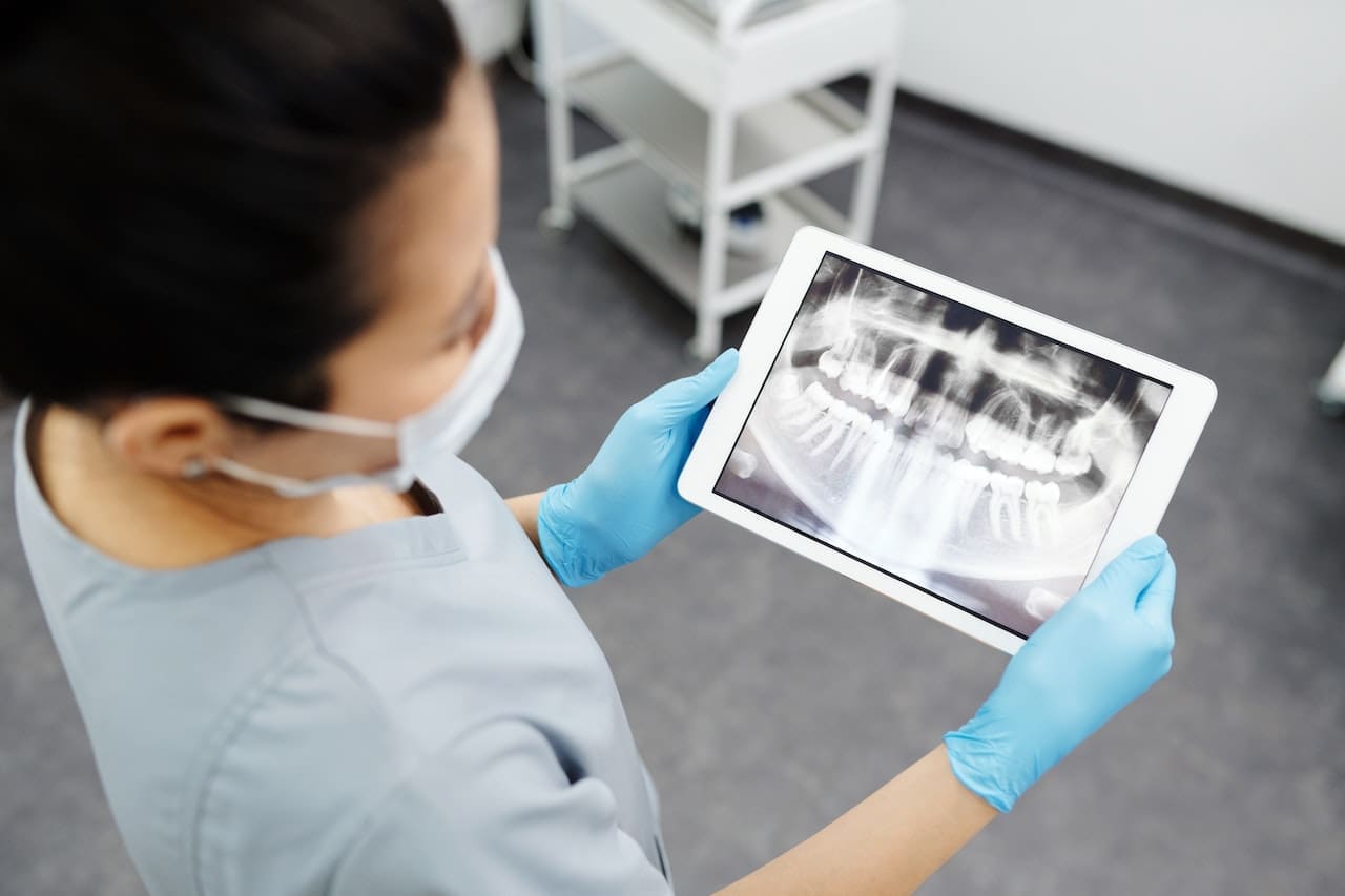 dentist holding teeth xray