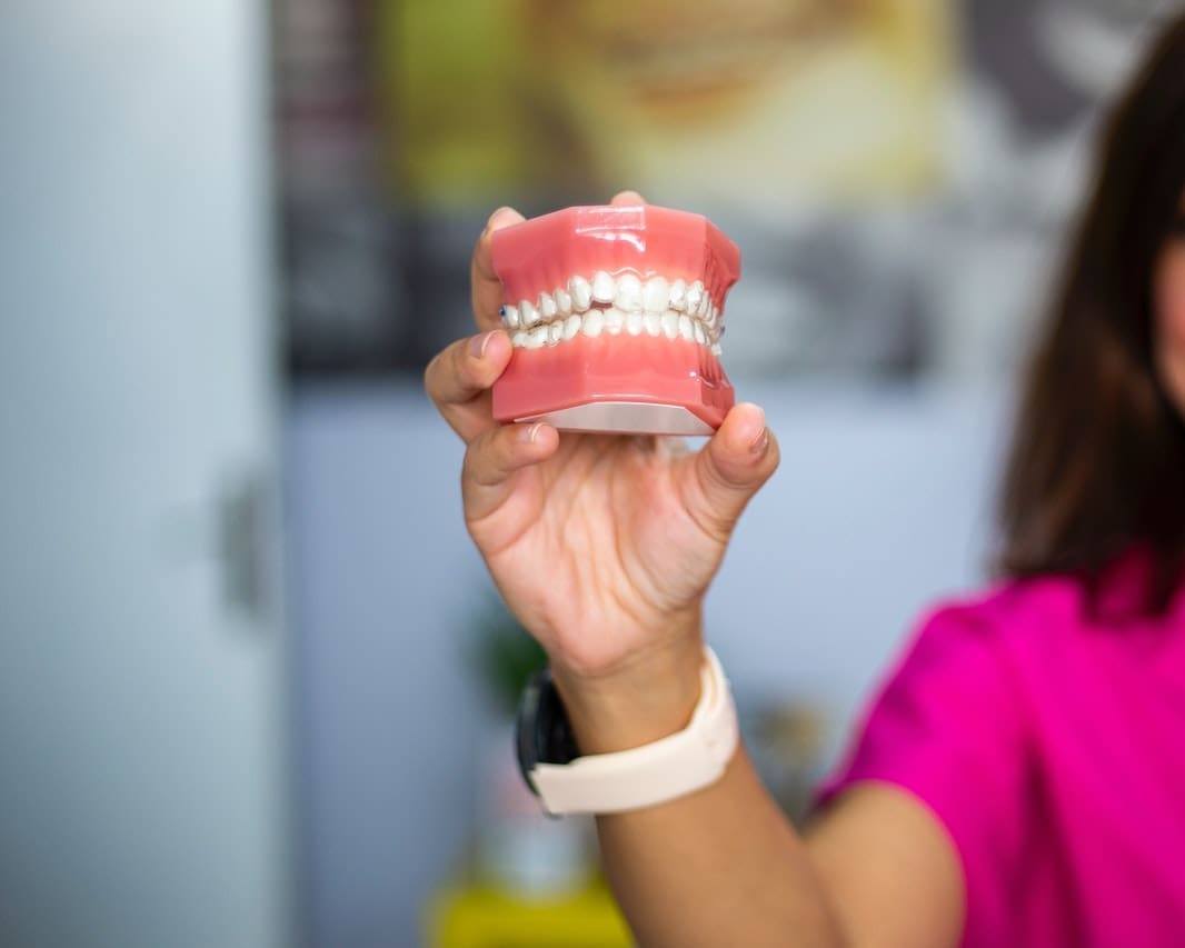 Person in dental office holding a model of the teeth