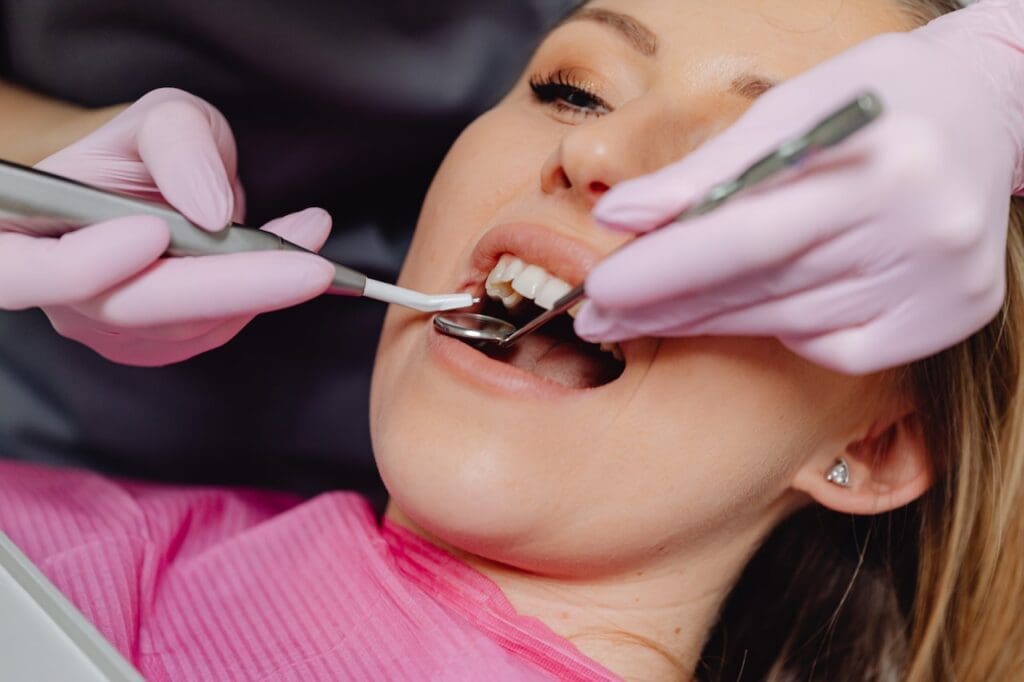 Close-up of dental veneers, showcasing their thin, custom-made porcelain layers designed to cover the front surface of teeth.