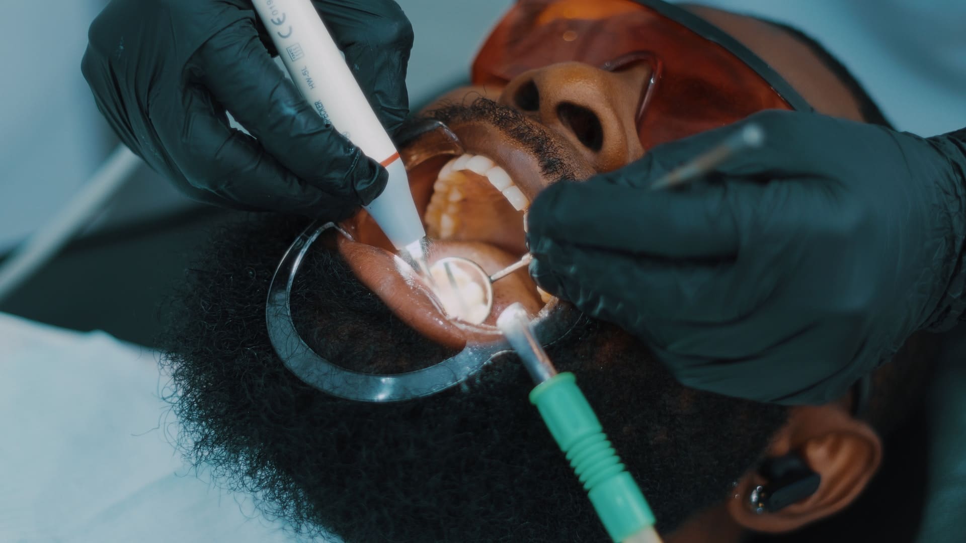 A dentist fitting a dental crown on a patient's tooth, using precise tools and techniques