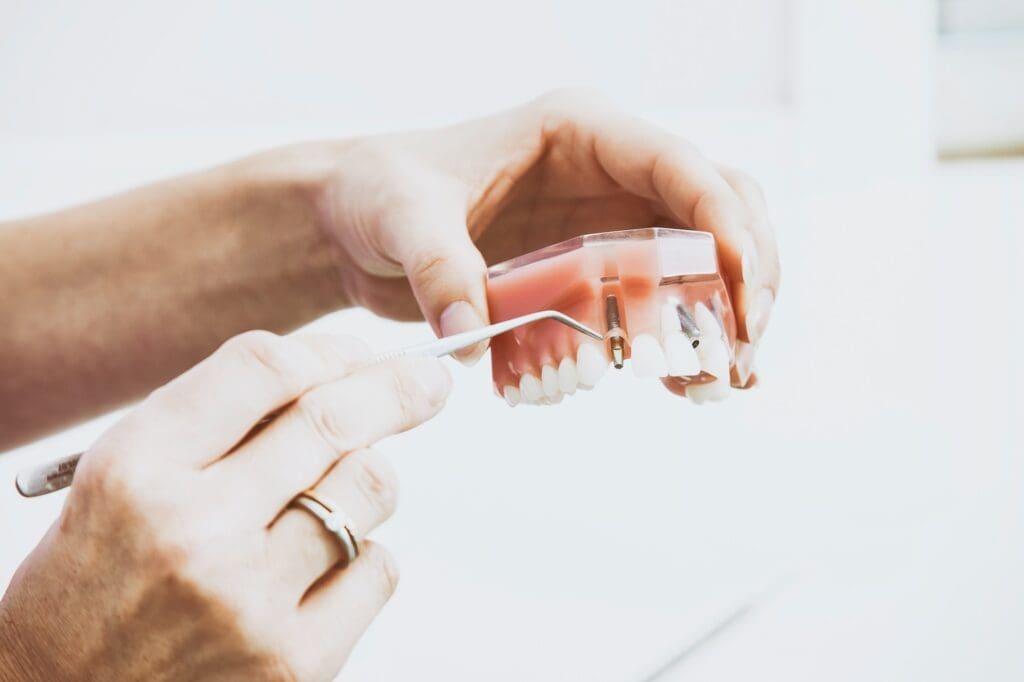 Dentist holding a model of the mouth with a dental implant replacing one tooth