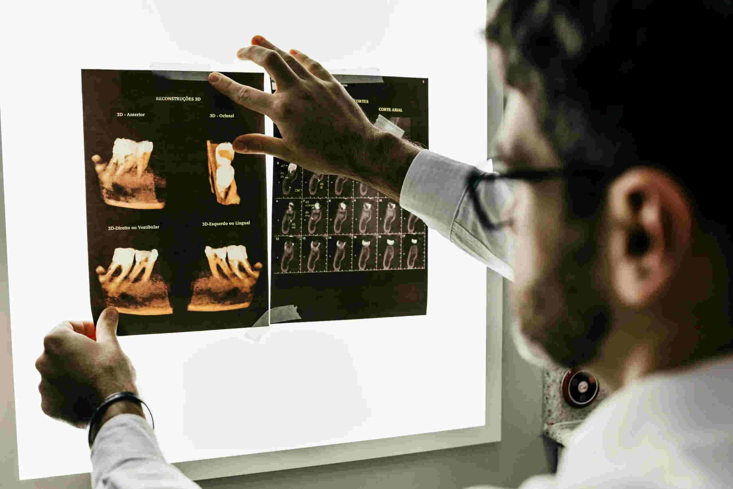 Doctor reviewing digital X-rays of a patient's mouth.