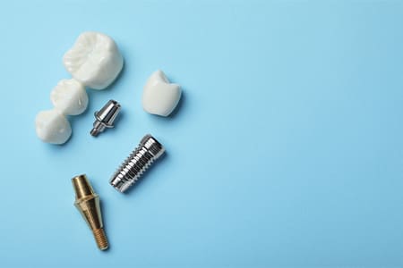 Dental implant and dental bridge parts set against a blue background