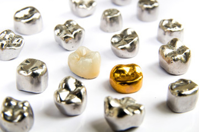 A collection of dental crowns and veneers displayed on a white background, showcasing various shapes and colors.